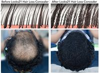 Looks21 Hair Loss Concealer (12gm / 0.42oz, Black)